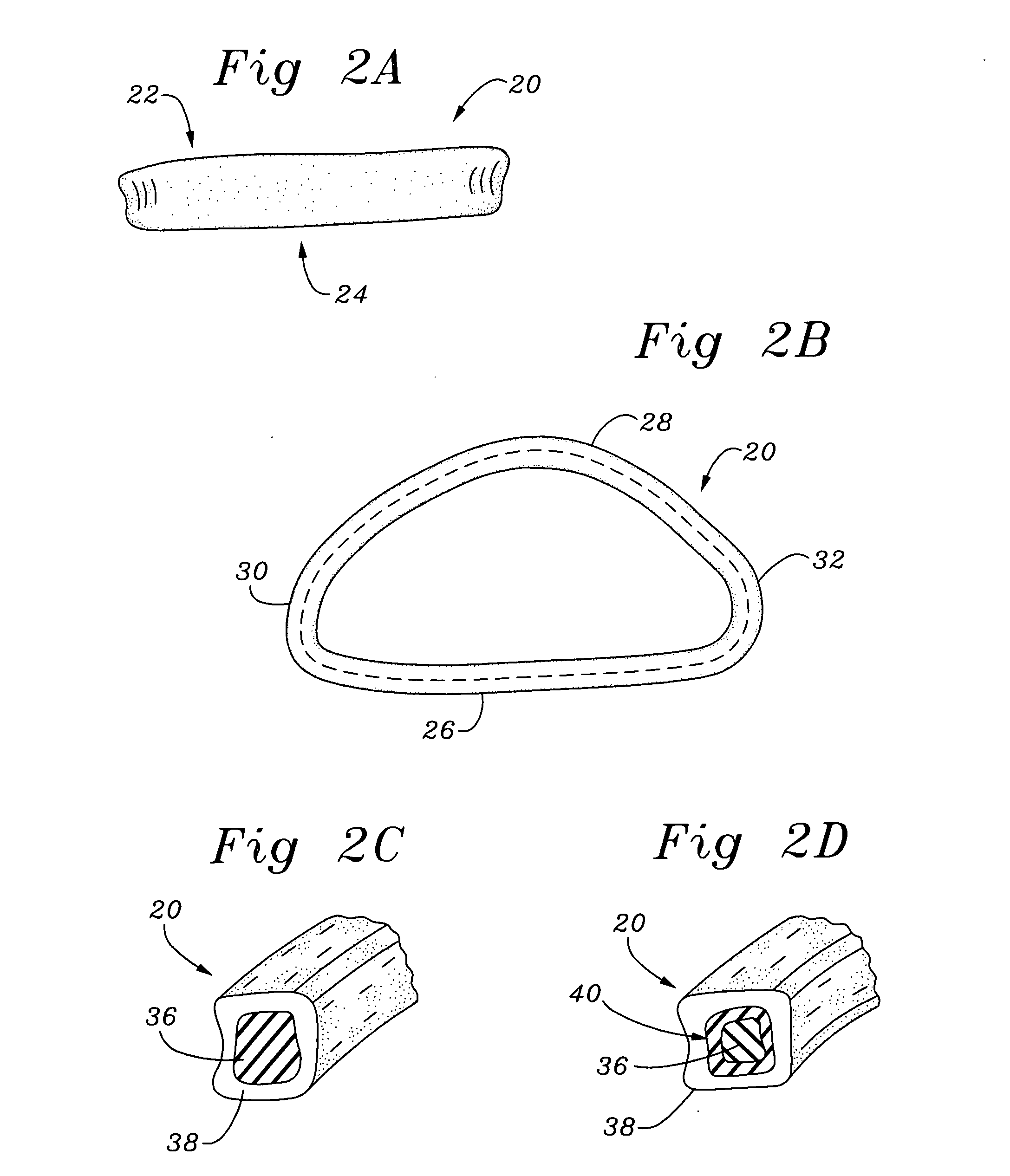 Self-molding annuloplasty ring