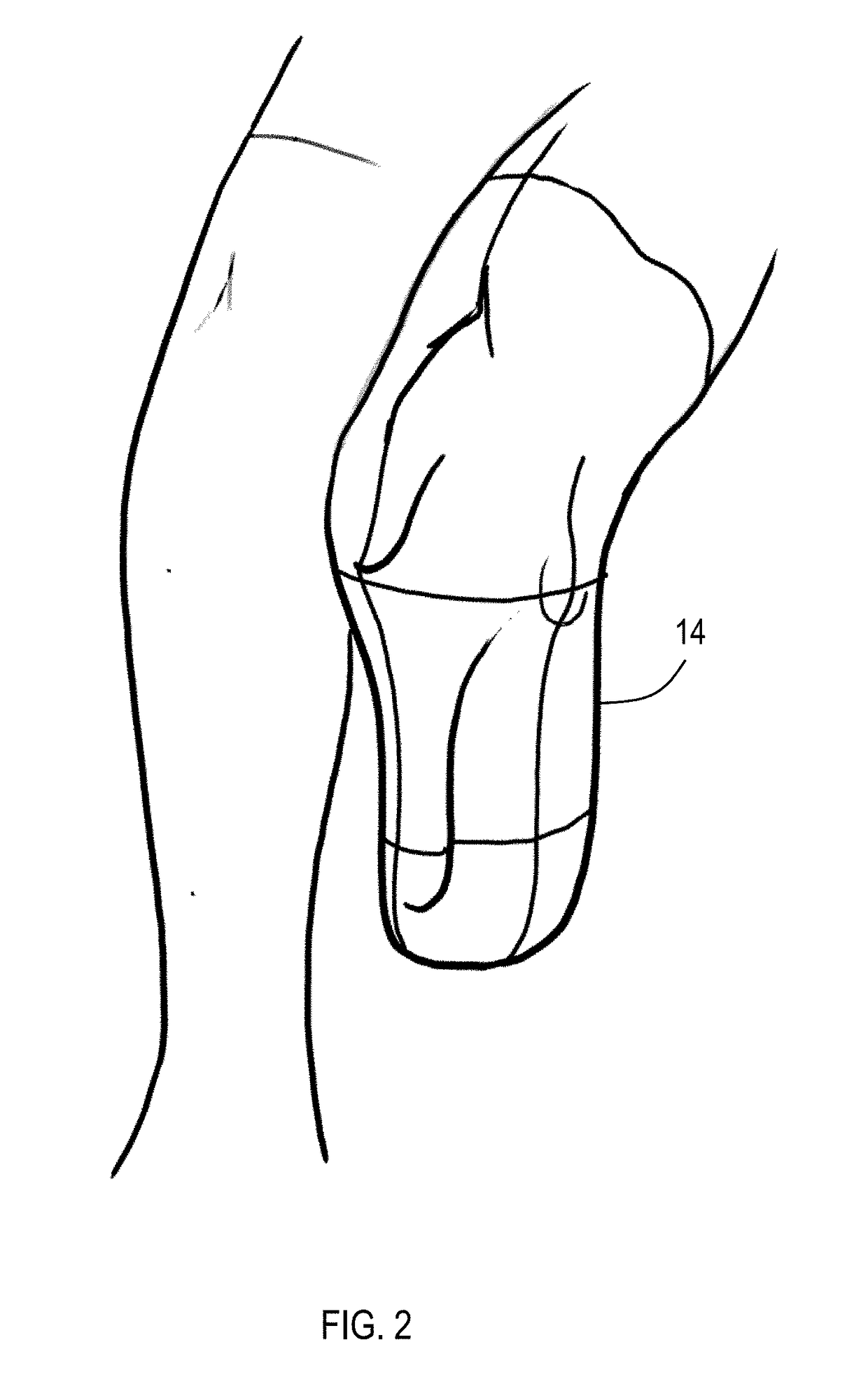 Prosthetic limb socket with variable harness