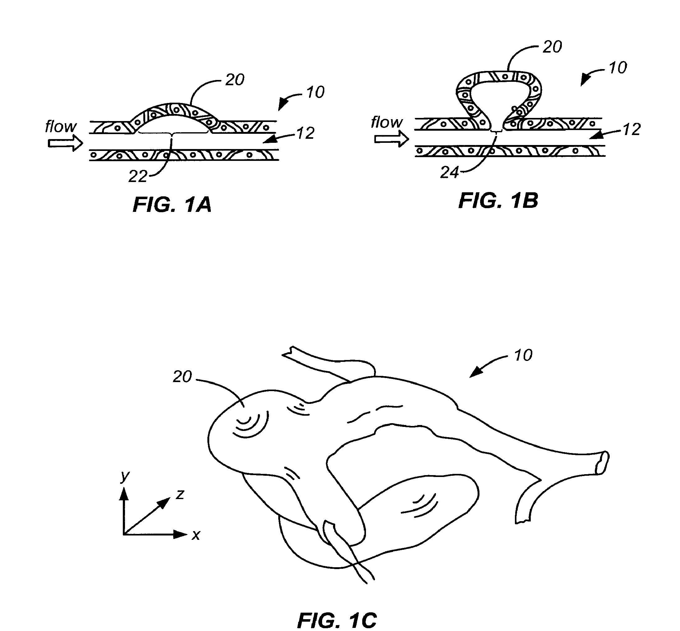 Devices and methods for accessing and treating an aneurysm