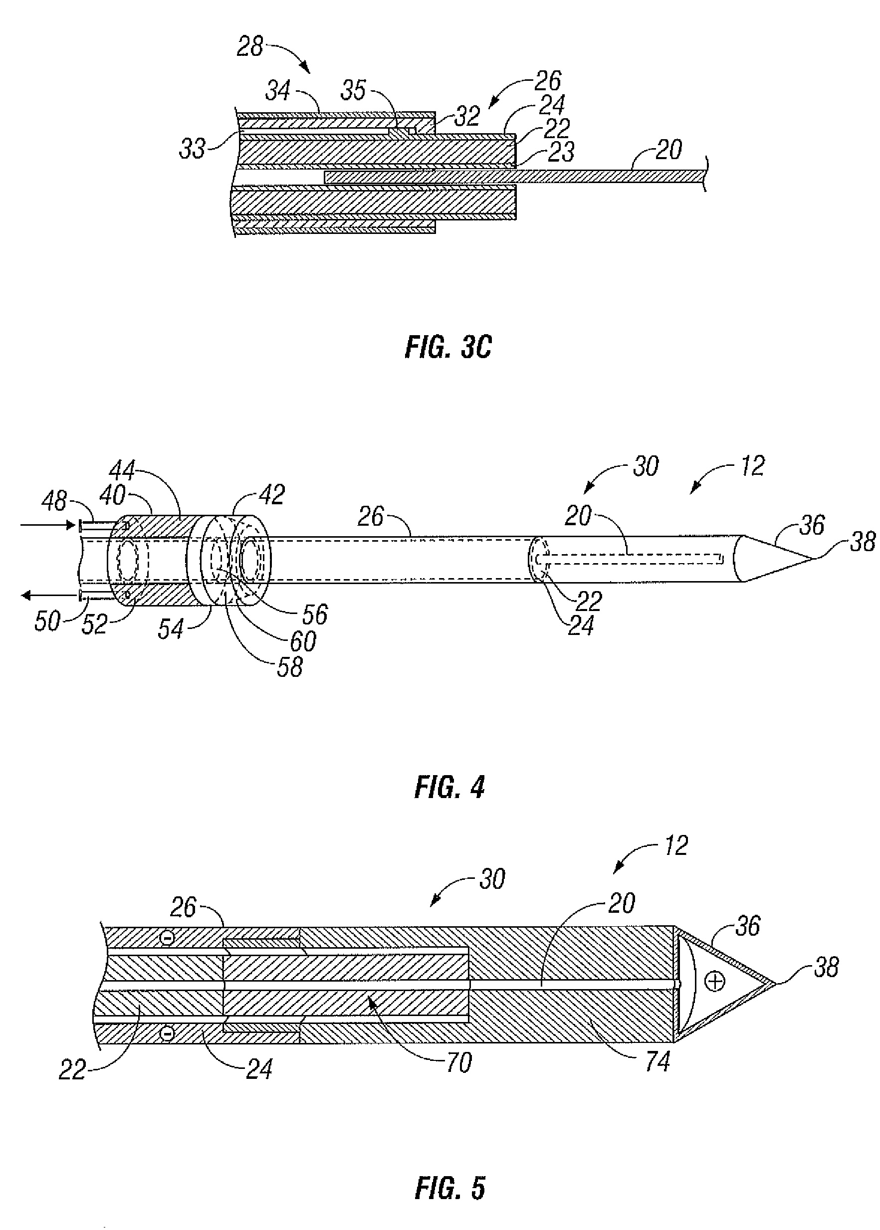 Dynamically Matched Microwave Antenna for Tissue Ablation