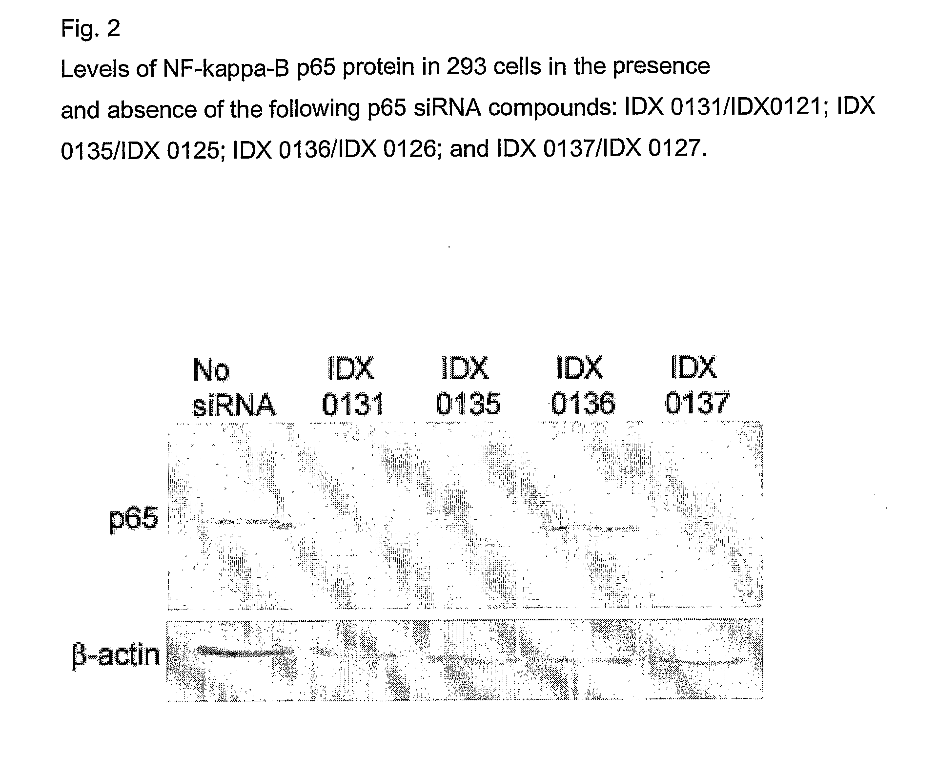 Compounds and Methods for Rna Interference of the P65 Subunit of Nf-Kappa-B