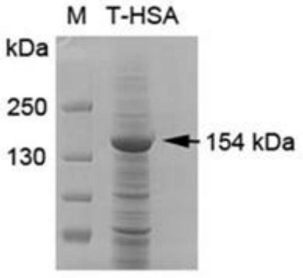 Adamts13-mdtcs fusion protein with extended half-life in vivo and its application