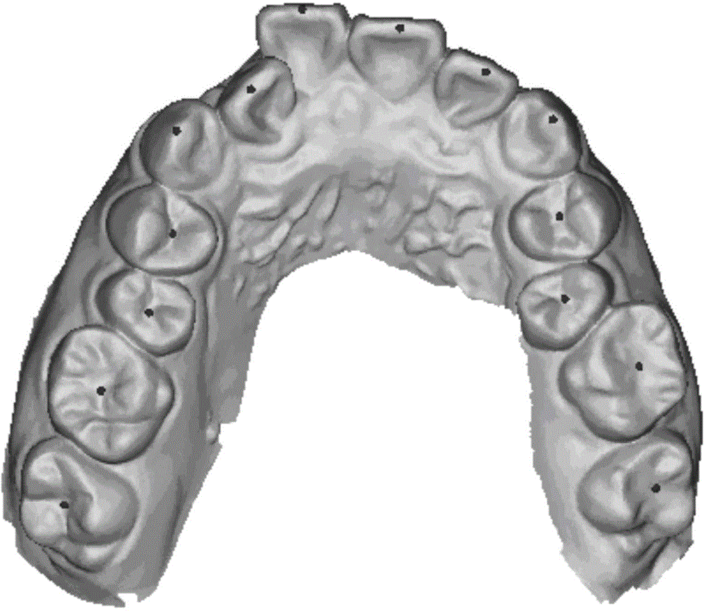 Dental crown data extraction method based on digital model