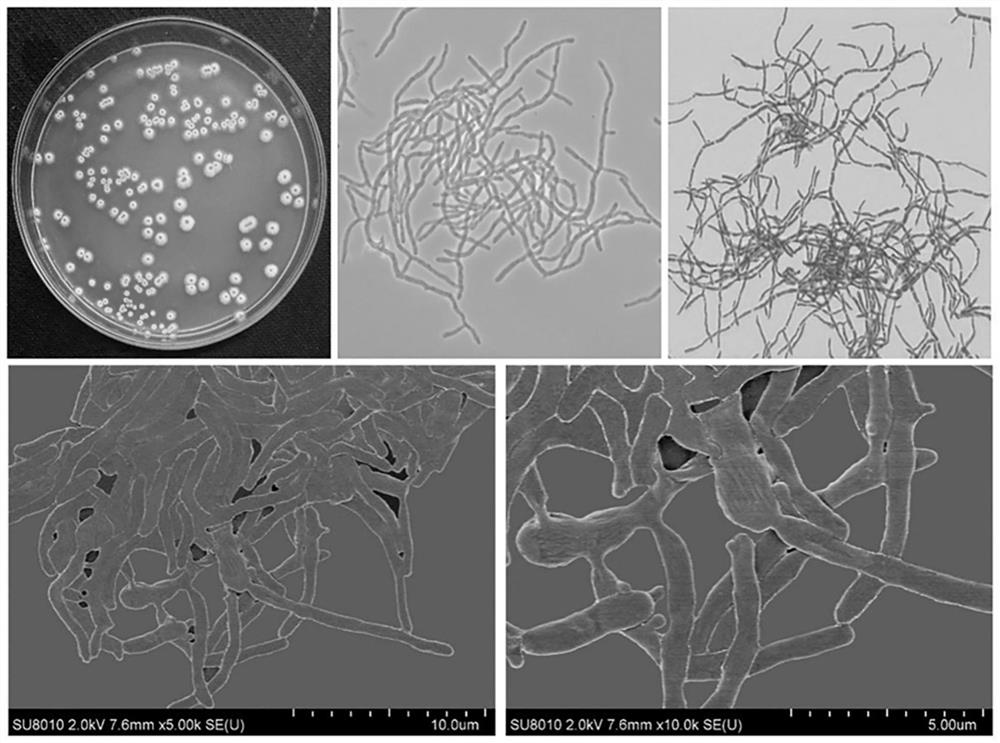 Streptomyces lateritius Z1-26, microecological preparation and preparation method of microecological preparation