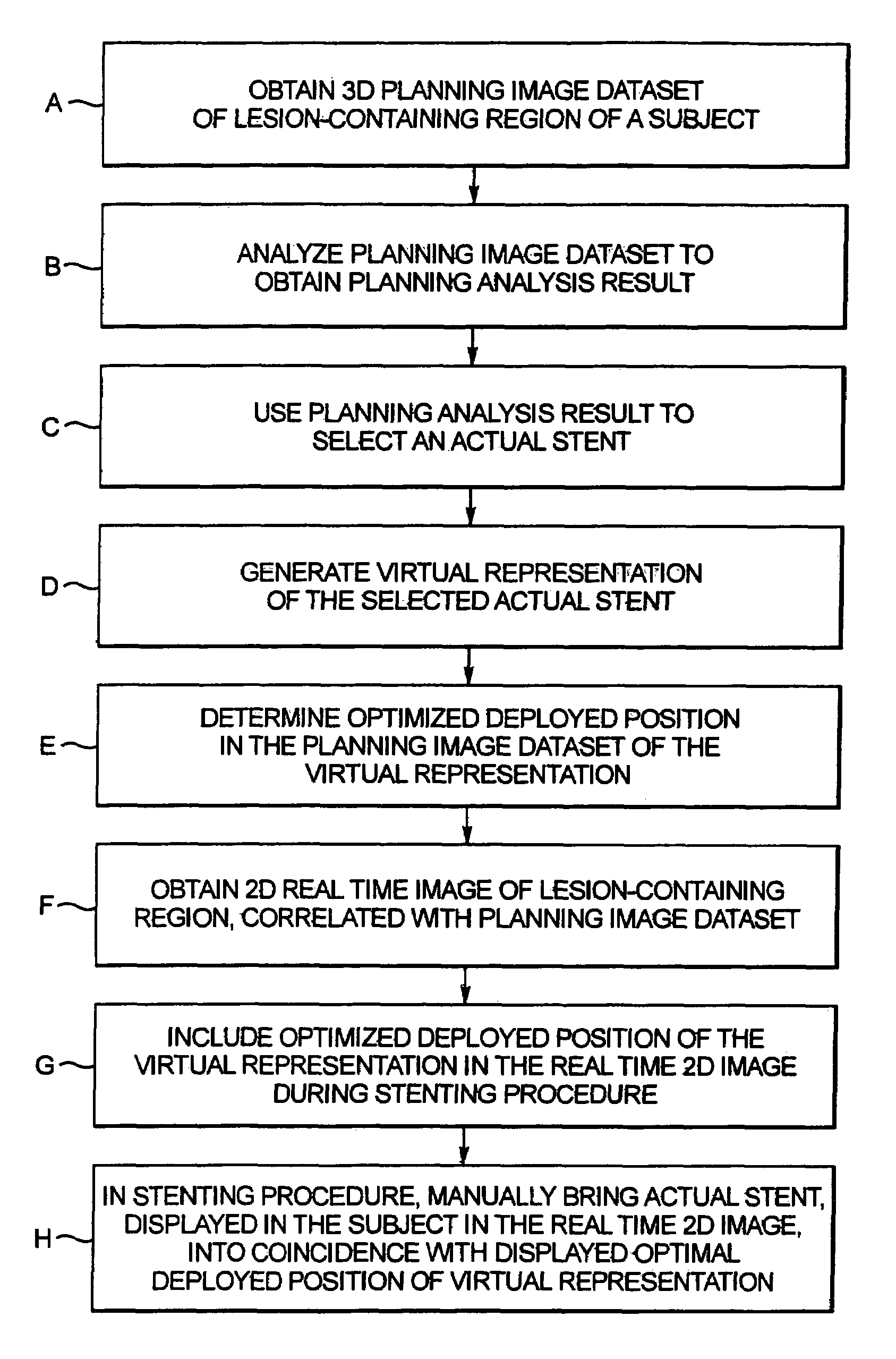 Computerized workflow method for stent planning and stenting procedure