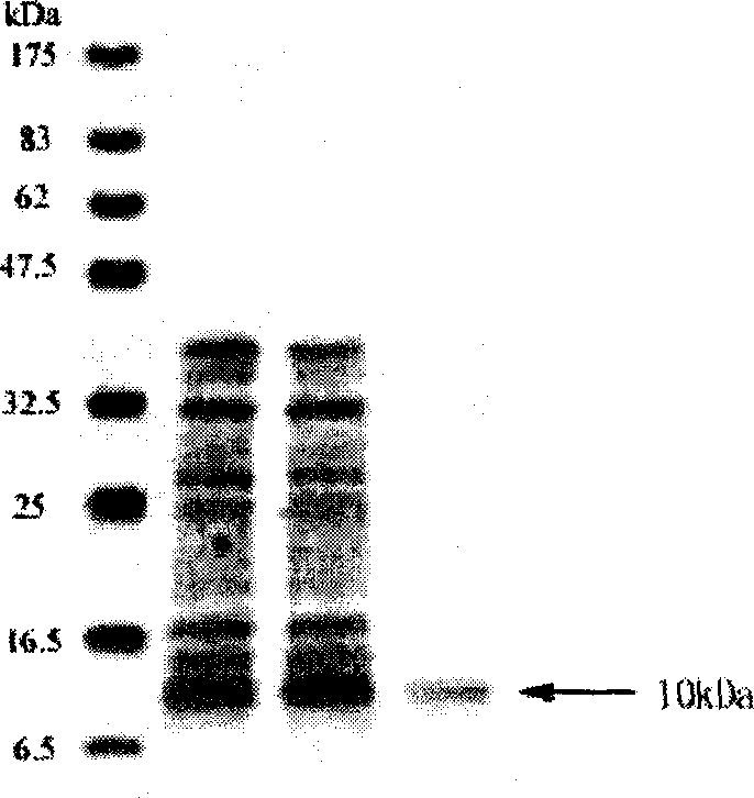 Polypeptide-human protein containing linking protein family characteristic sequential fragment-9.68 and polynucleotide for encoding it