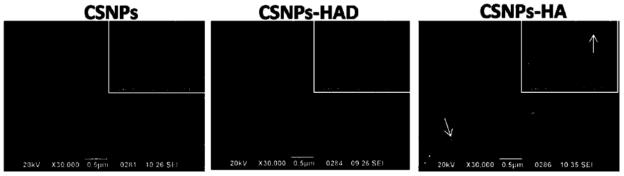 Preparation method of gene targeting delivery system for tumors with high CD44 expression