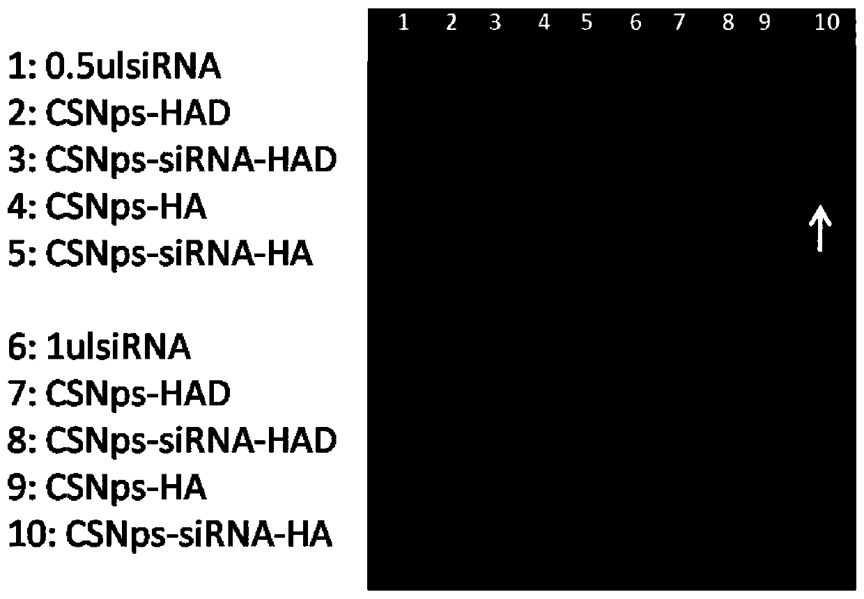 Preparation method of gene targeting delivery system for tumors with high CD44 expression