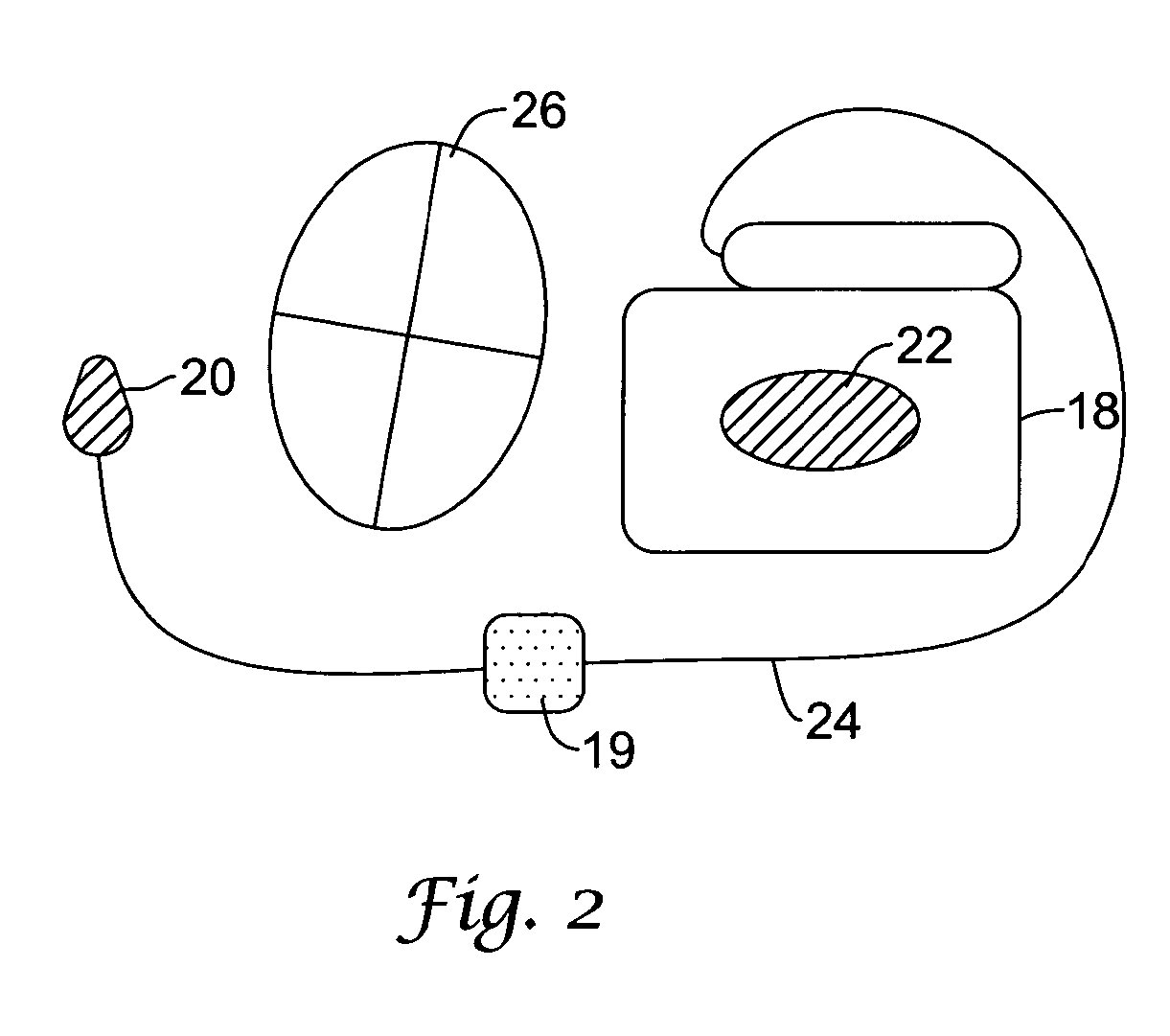 Multiple electrode vectors for implantable cardiac treatment devices