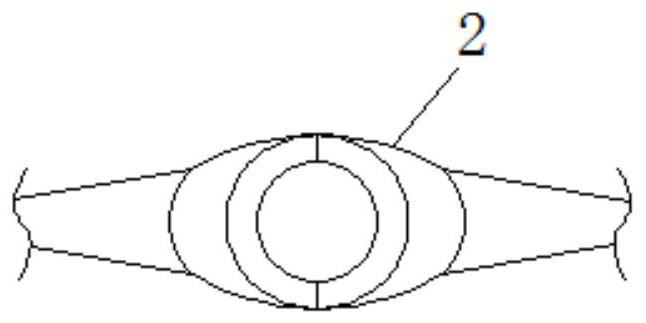 Fixing device for oral-cavity intubation tube