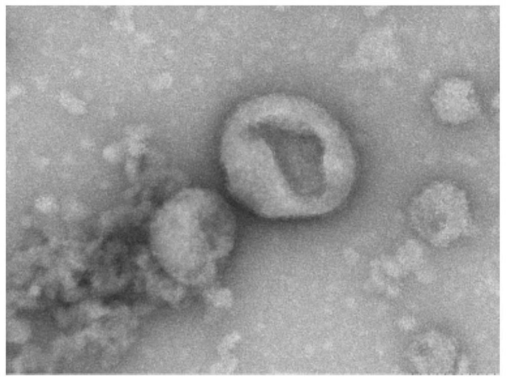 Blood exosome marker for judging buffalo birth time and application of blood exosome marker