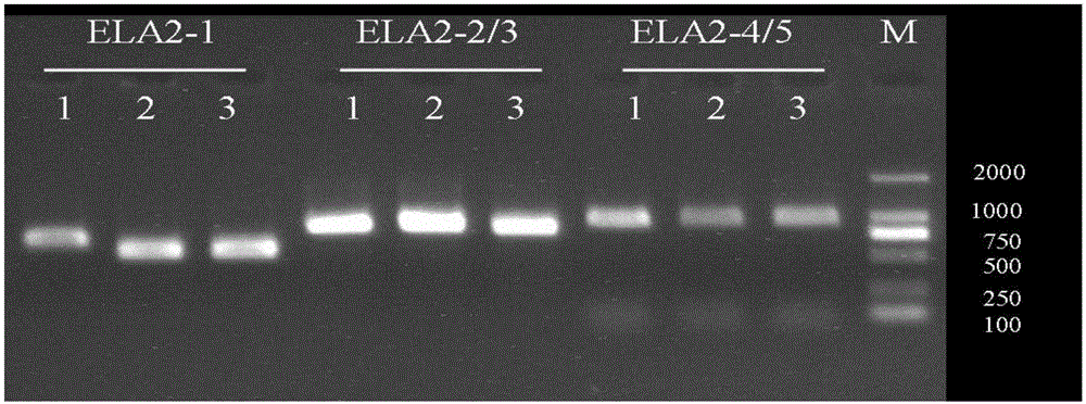 Method and primer for detecting ELA2 gene