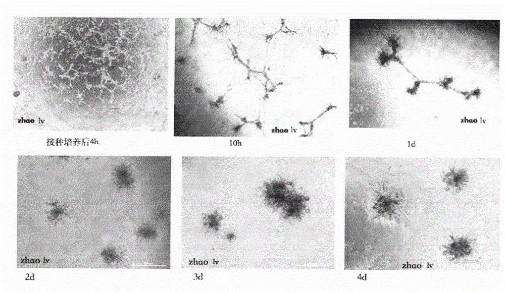 In vitro construction method for salivary glands organs and acinus