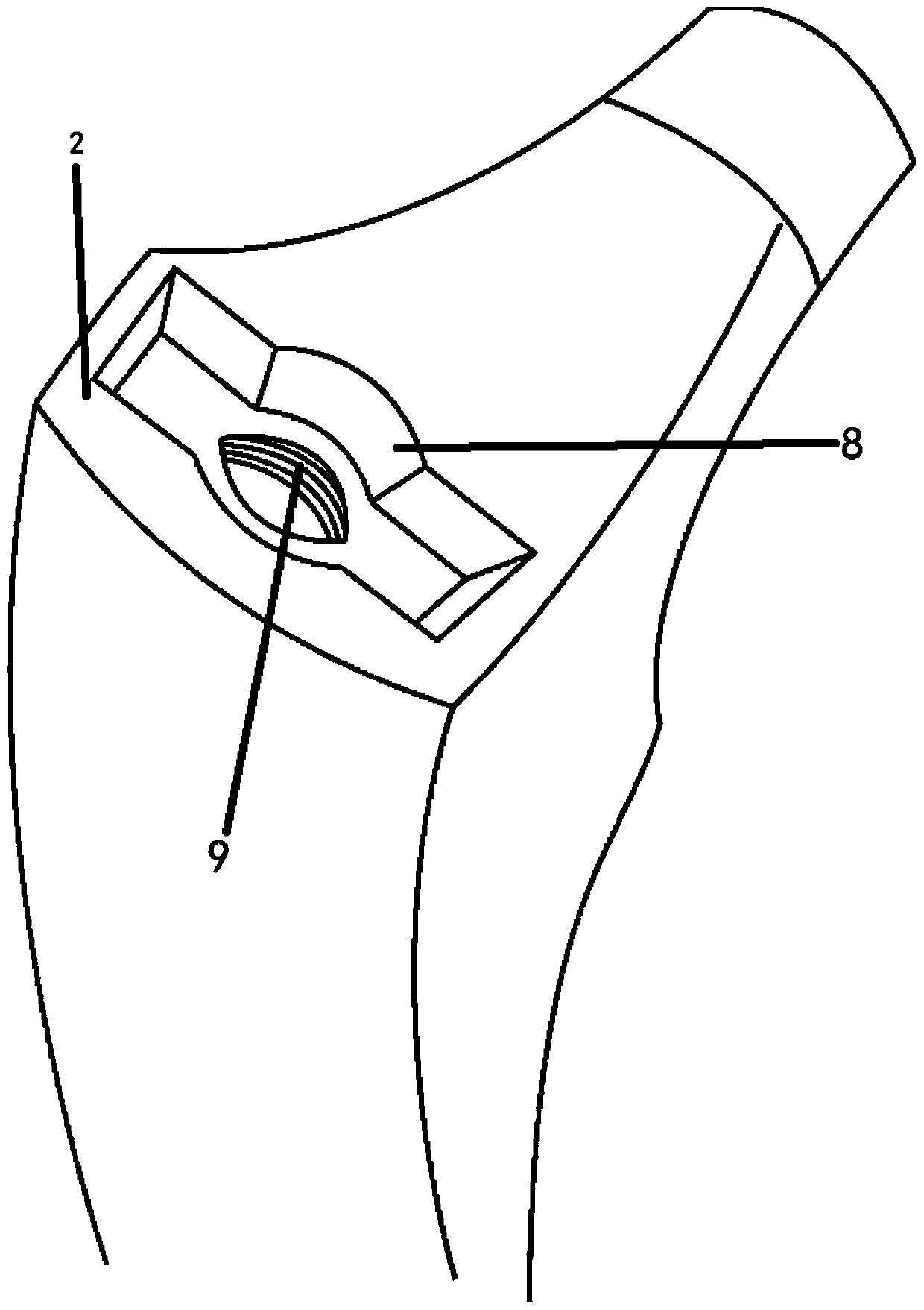 Artificial femoral stem prosthesis used for greater trochanter fracture and fitting method