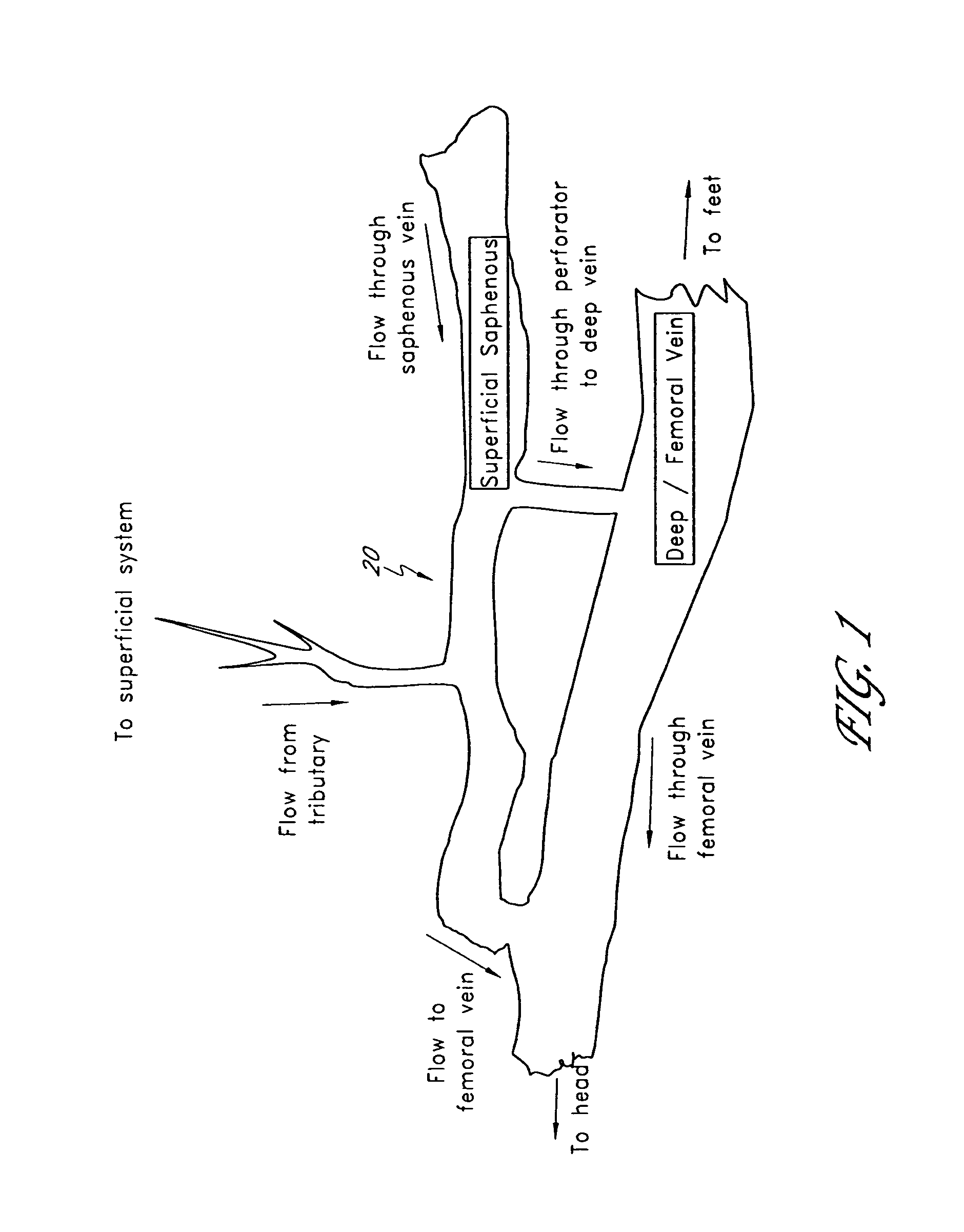 Occlusive implant and methods for hollow anatomical structure