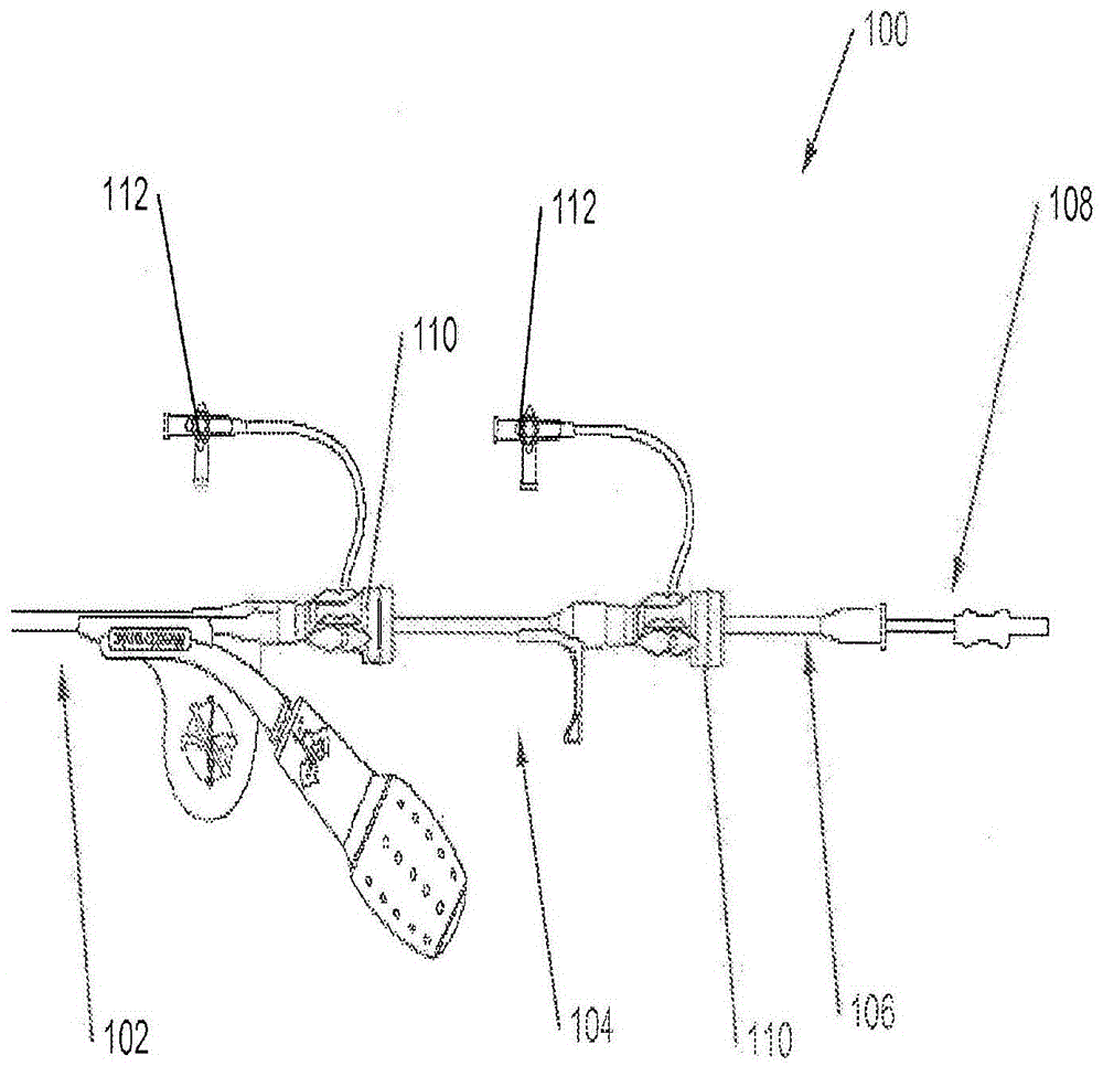 Telescoping Catheter Delivery System for Intracardiac Device Placement in the Left Heart
