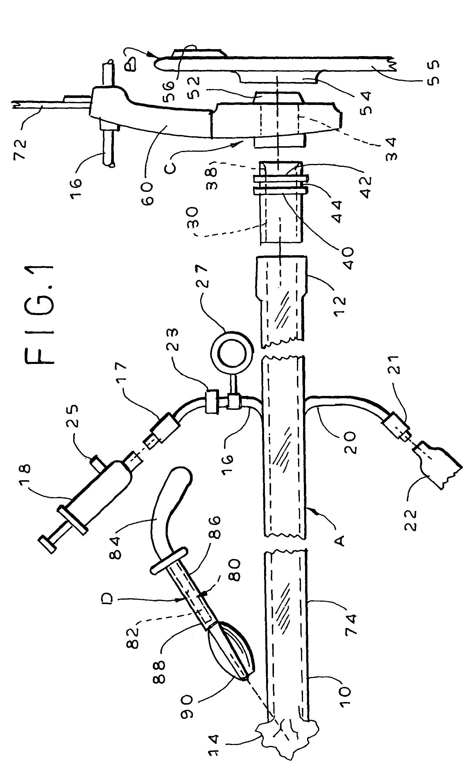 Fecal management appliance and method and apparatus for introducing same