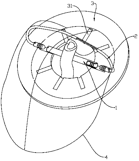 Intestinal loop type stoma stent and stoma bag using intestinal loop type stoma stent