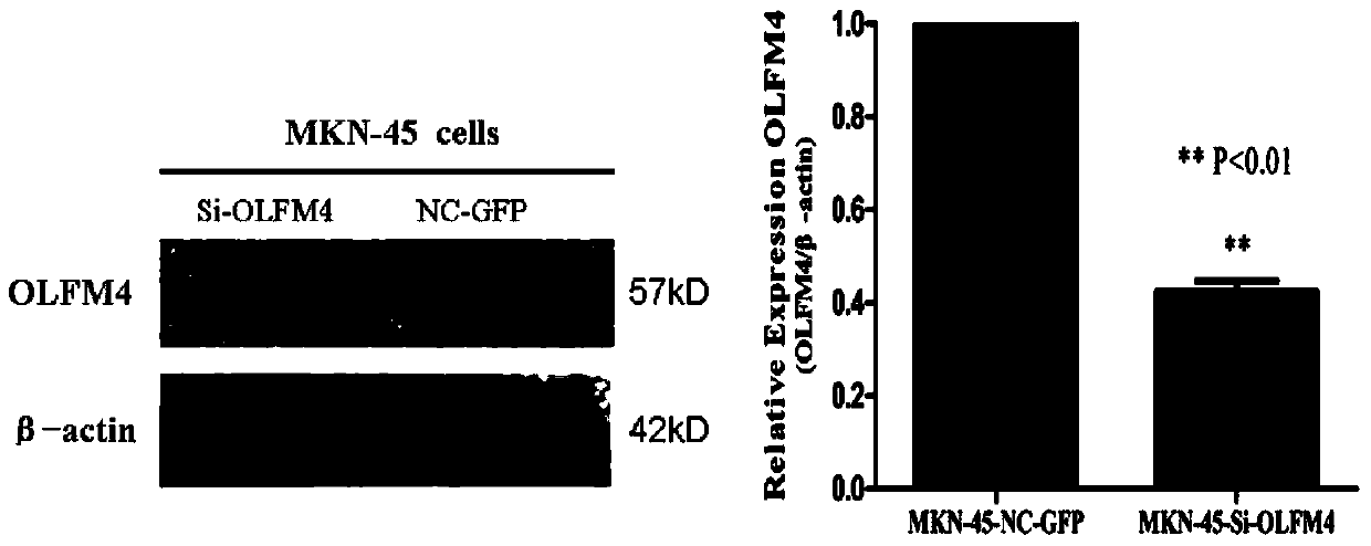 Interfering RNA and lentivirus targeted to OLFM4 gene, and application thereof