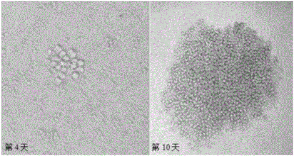 Monoclonal antibody capable of secreting anti-streptococcus suis 2 AK (Aspartokinase) protein and application thereof