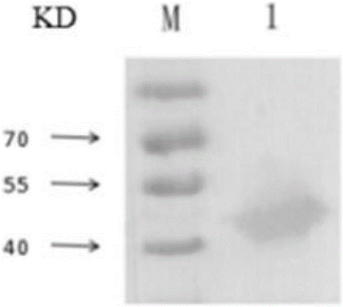 Monoclonal antibody capable of secreting anti-streptococcus suis 2 AK (Aspartokinase) protein and application thereof