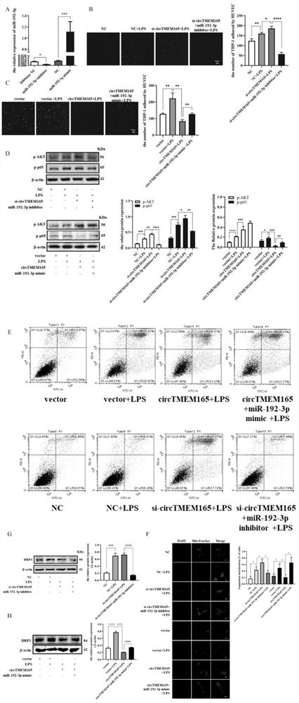 Application of circTMEM165 in preparation of products for diagnosing and/or treating cardiovascular diseases