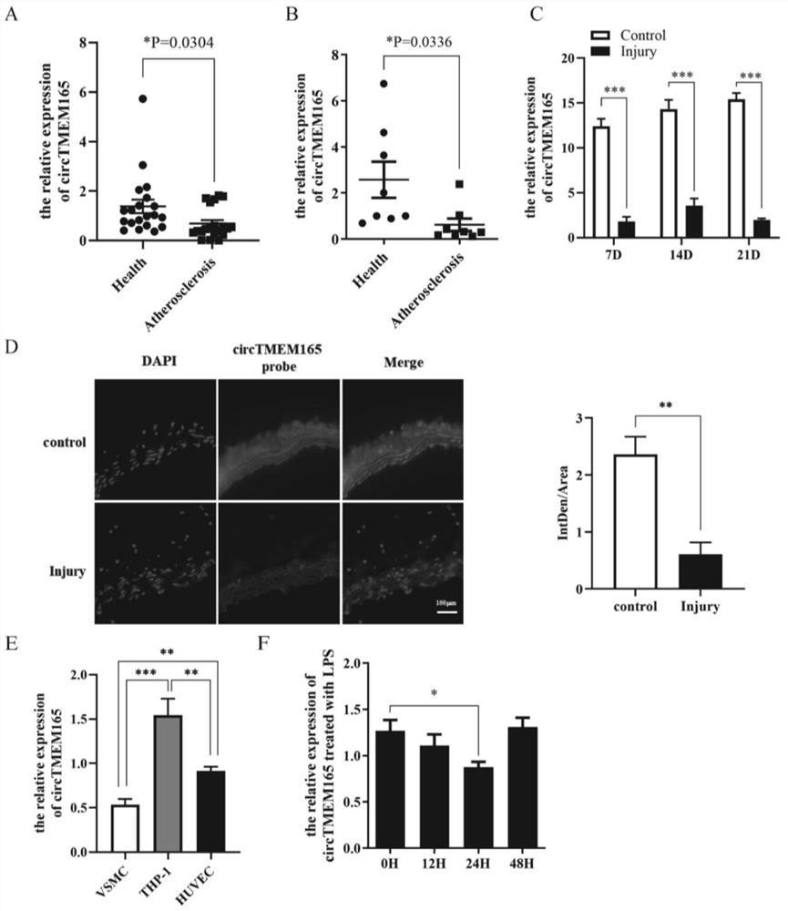 Application of circTMEM165 in preparation of products for diagnosing and/or treating cardiovascular diseases