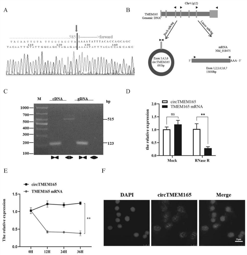 Application of circTMEM165 in preparation of products for diagnosing and/or treating cardiovascular diseases