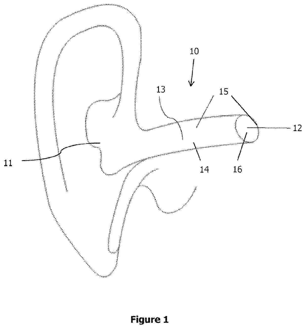 Electro-stimulation device for innervation of the external ear canal