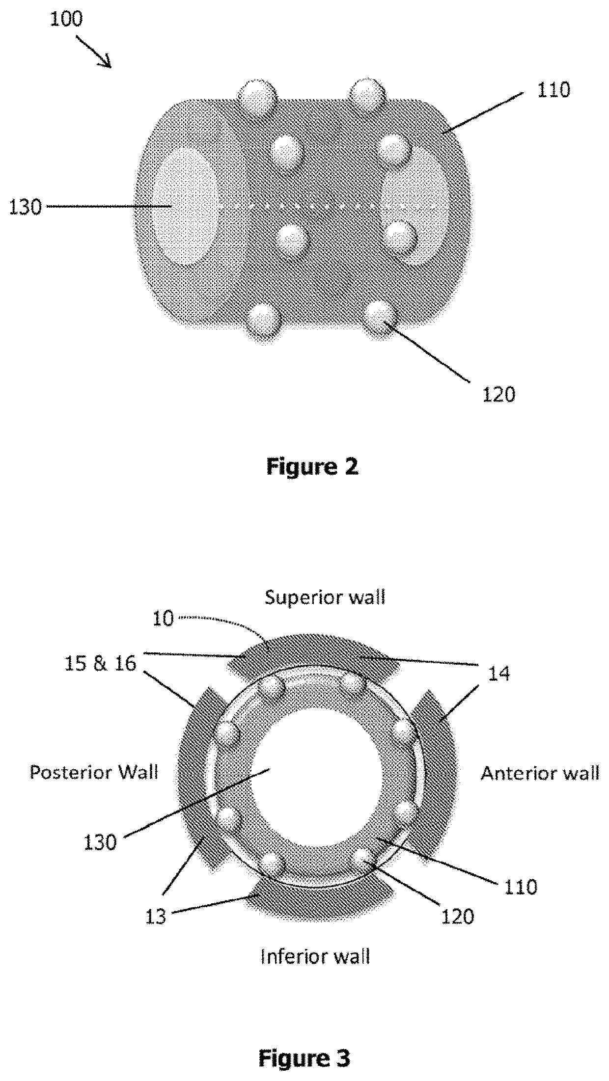 Electro-stimulation device for innervation of the external ear canal