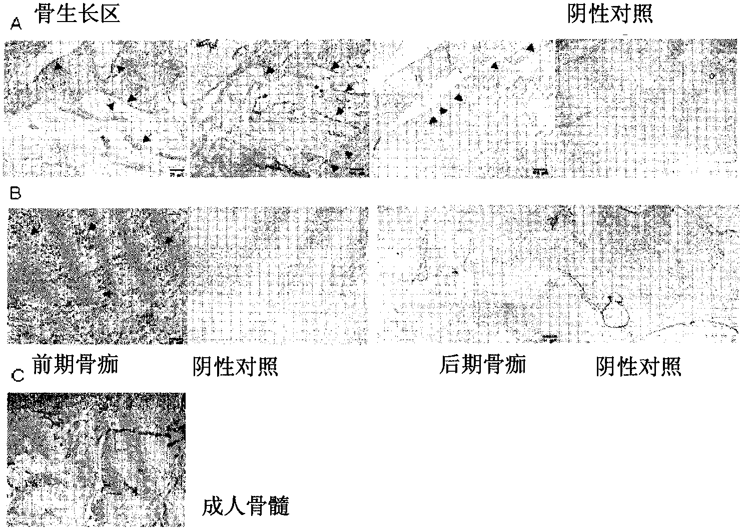 Use Of an isoform of Hla-G as an osteogenesis marker