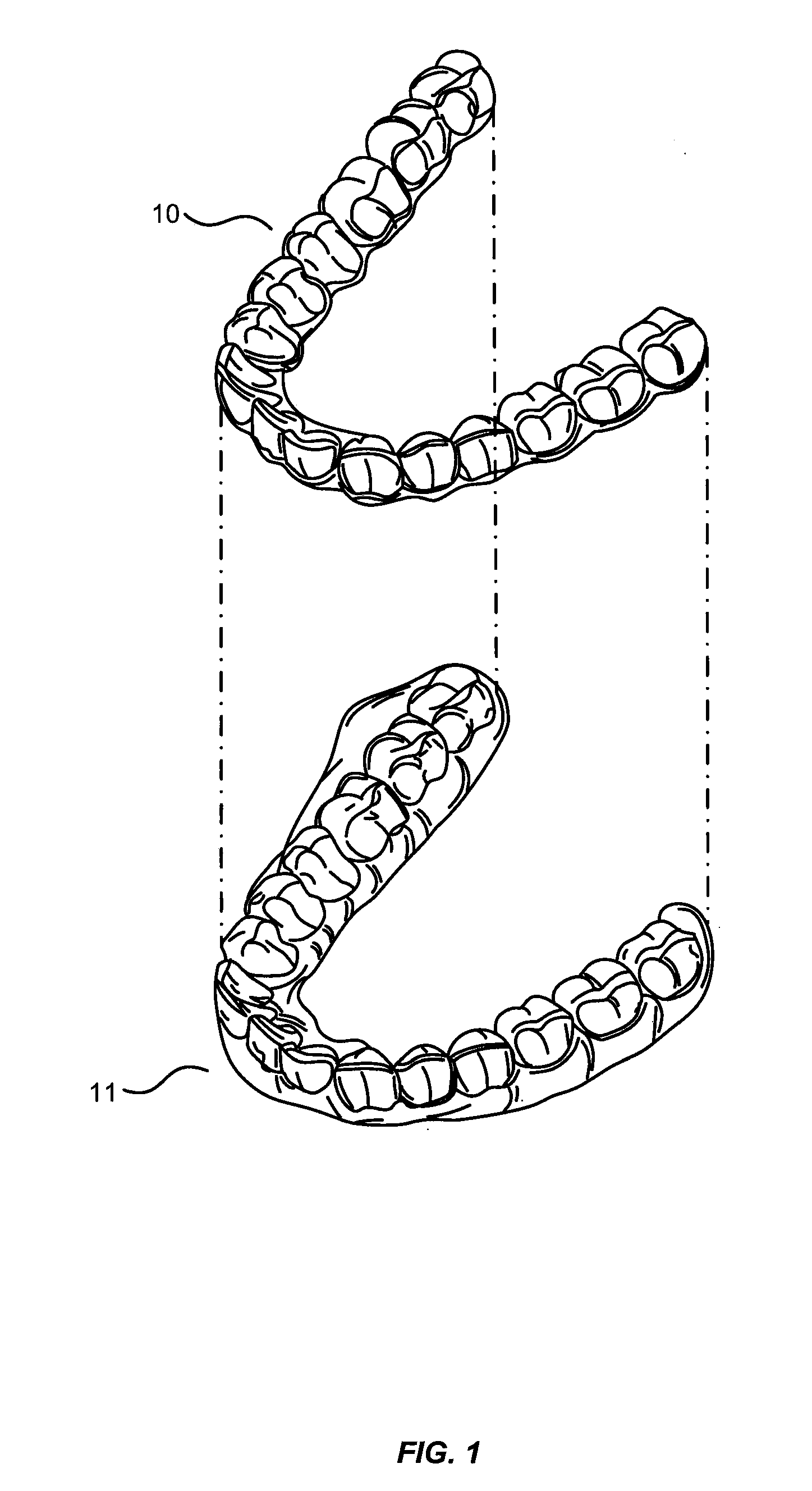 Tactile objects for orthodontics, systems and methods