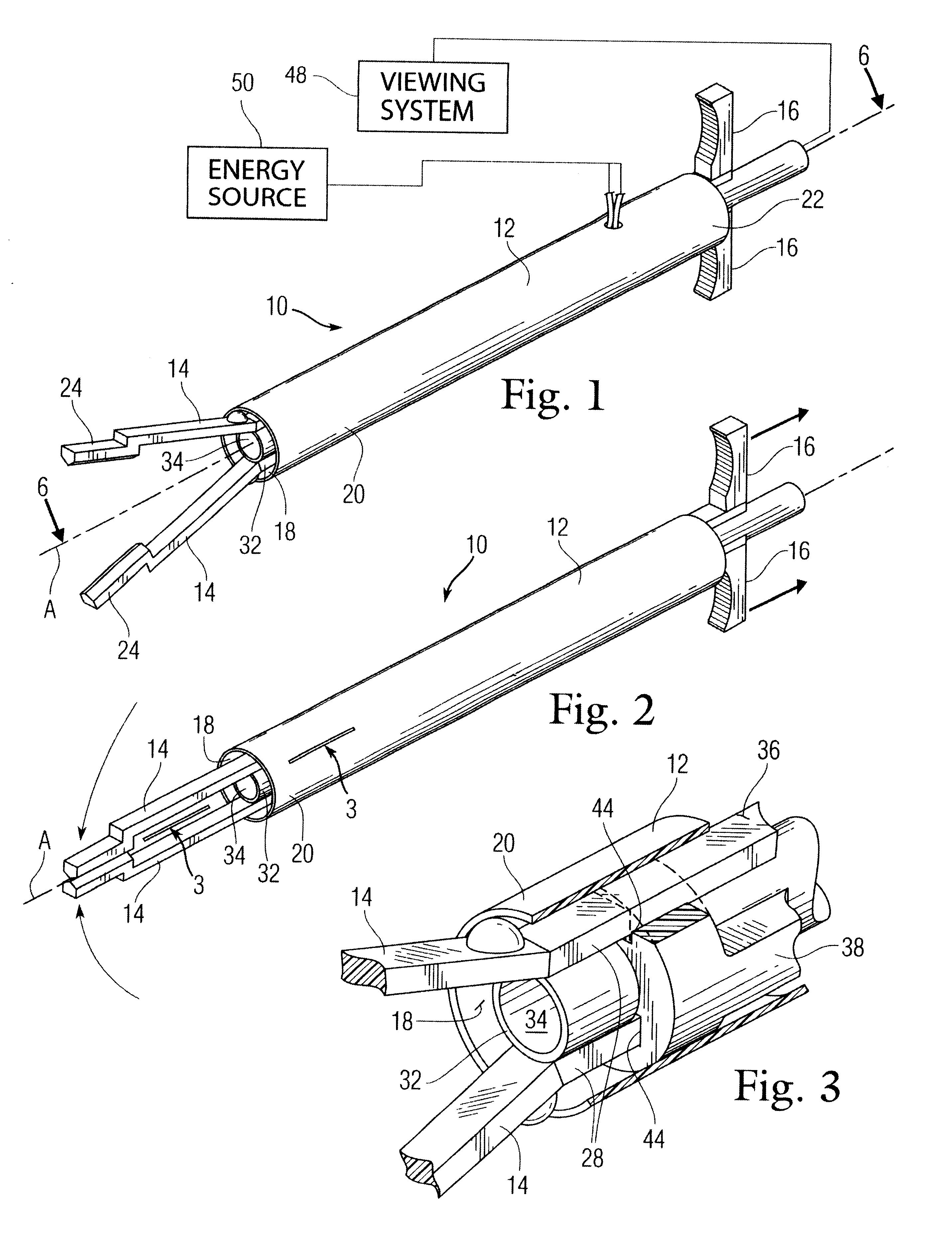 Occlusion apparatus and method for necrotizing anatomical tissue structures