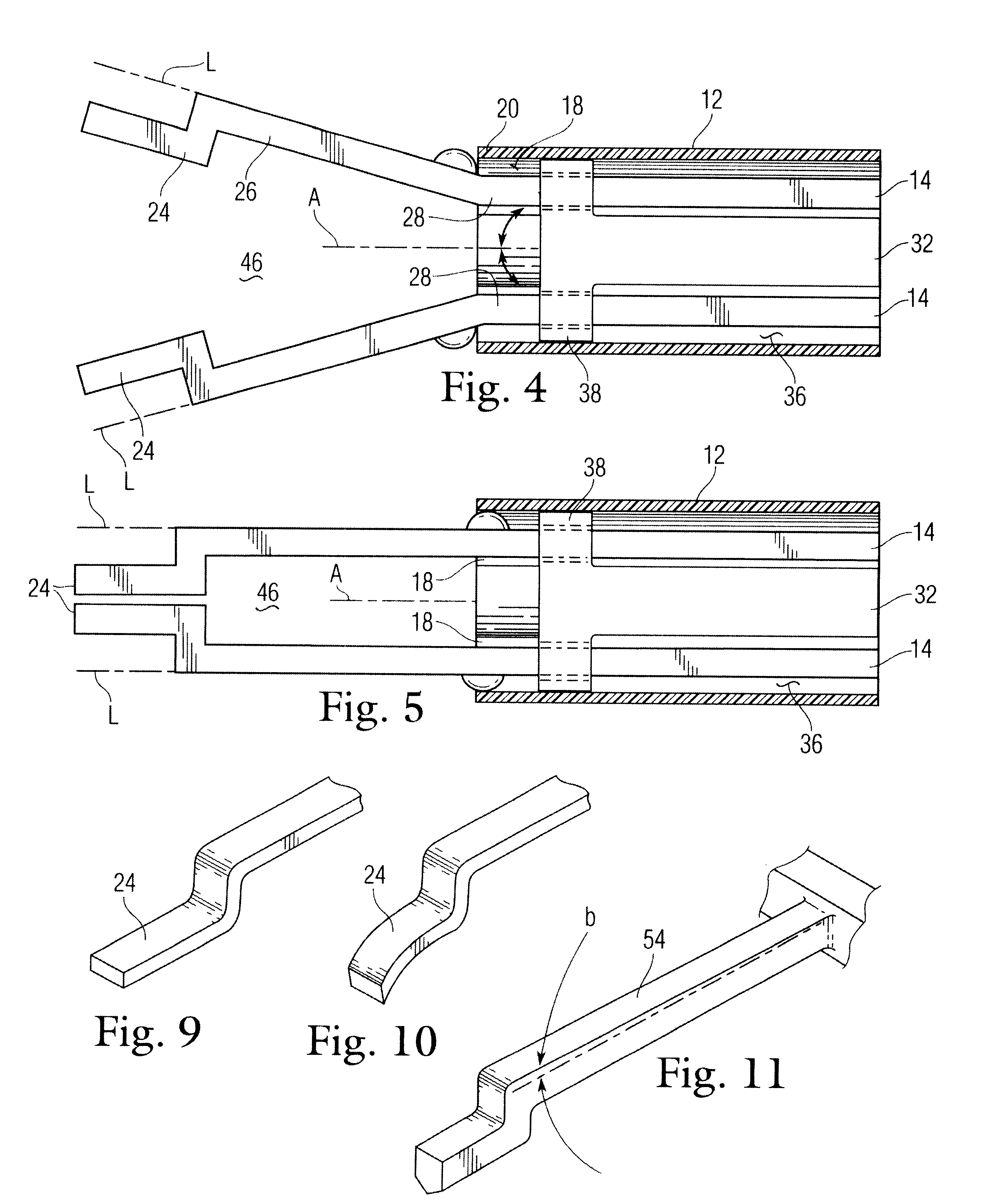 Occlusion apparatus and method for necrotizing anatomical tissue structures