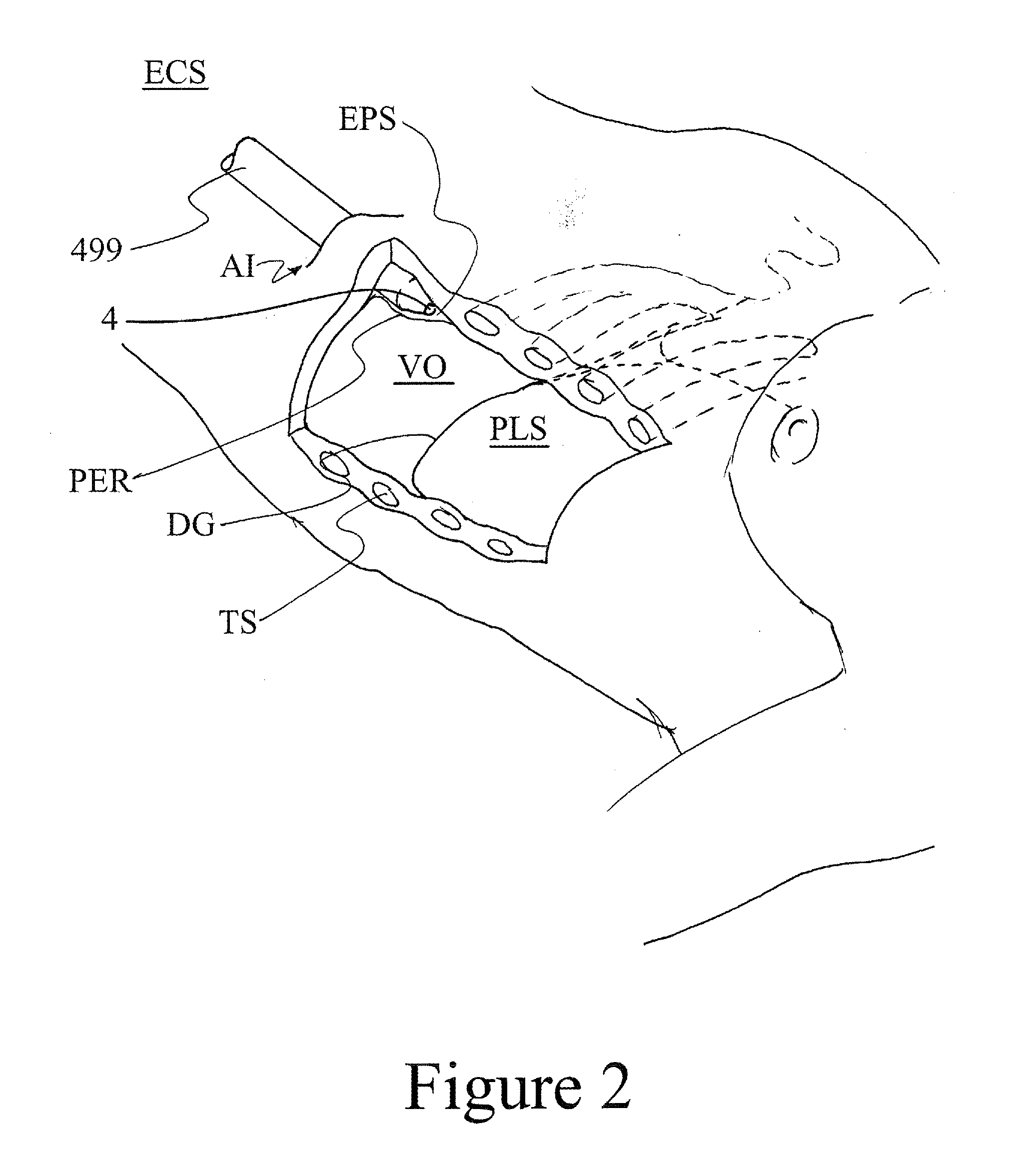 Surgical apparatus and method for performing transabdominal cardiac surgery