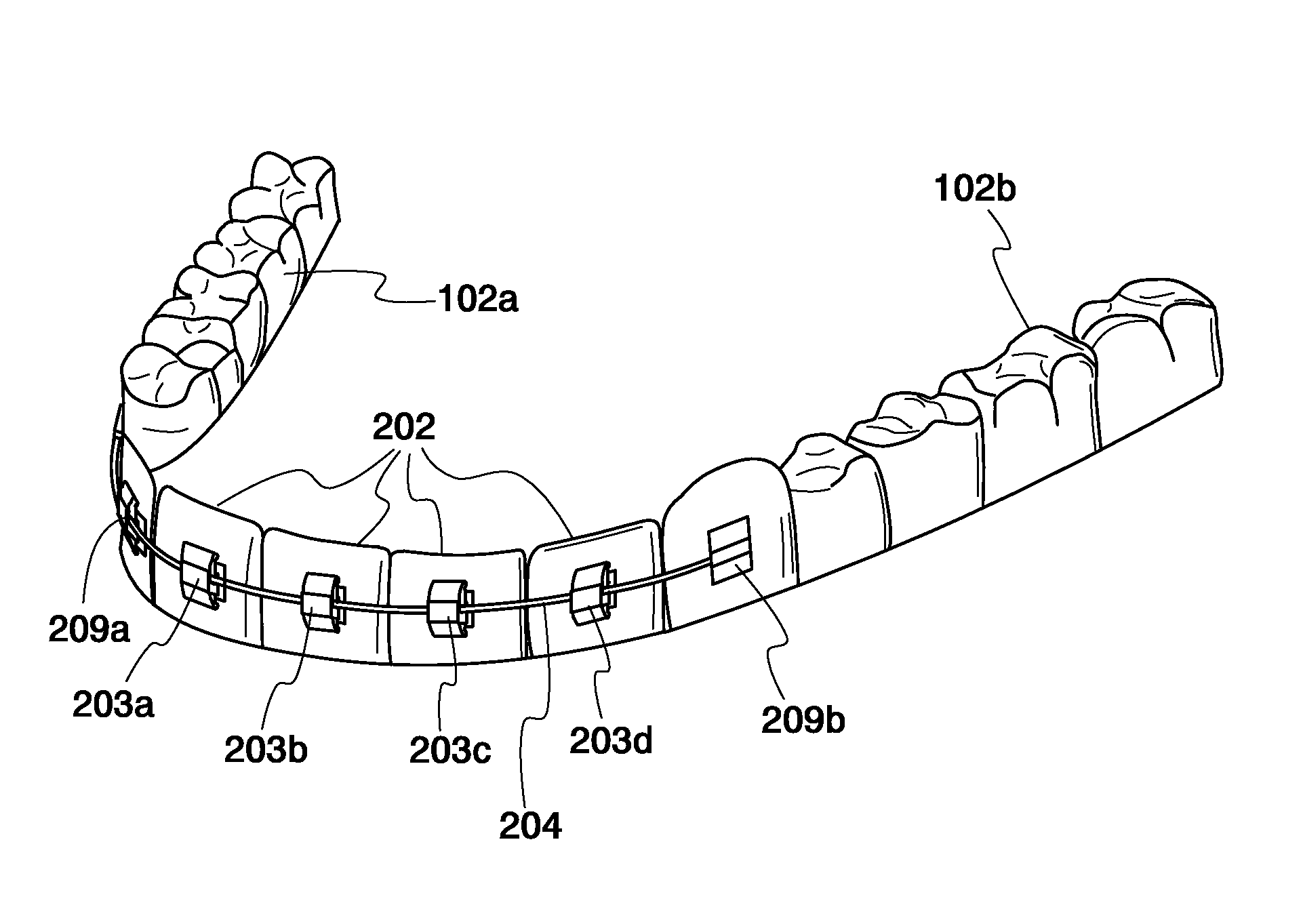 Magnetic orthodontic assembly