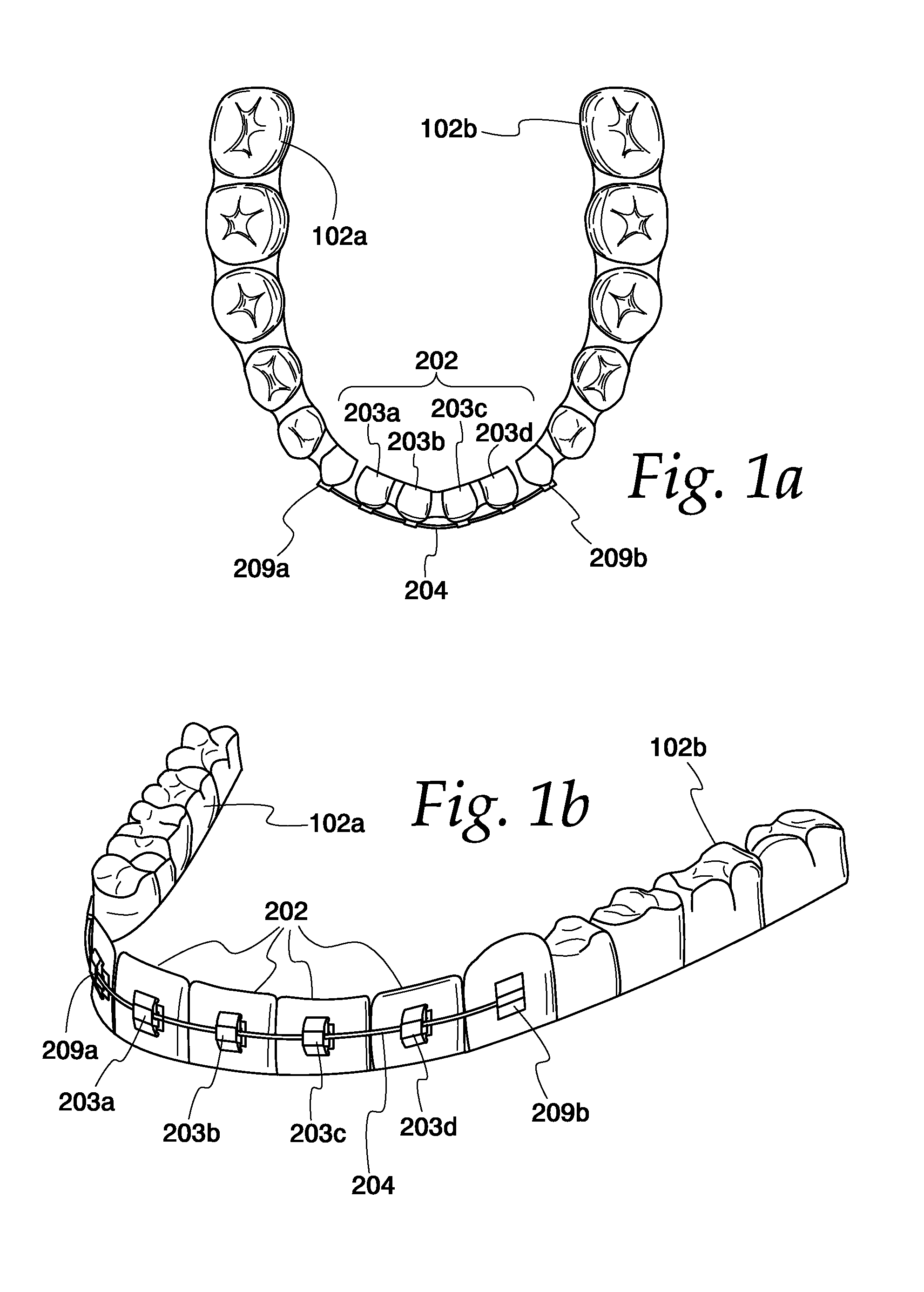 Magnetic orthodontic assembly
