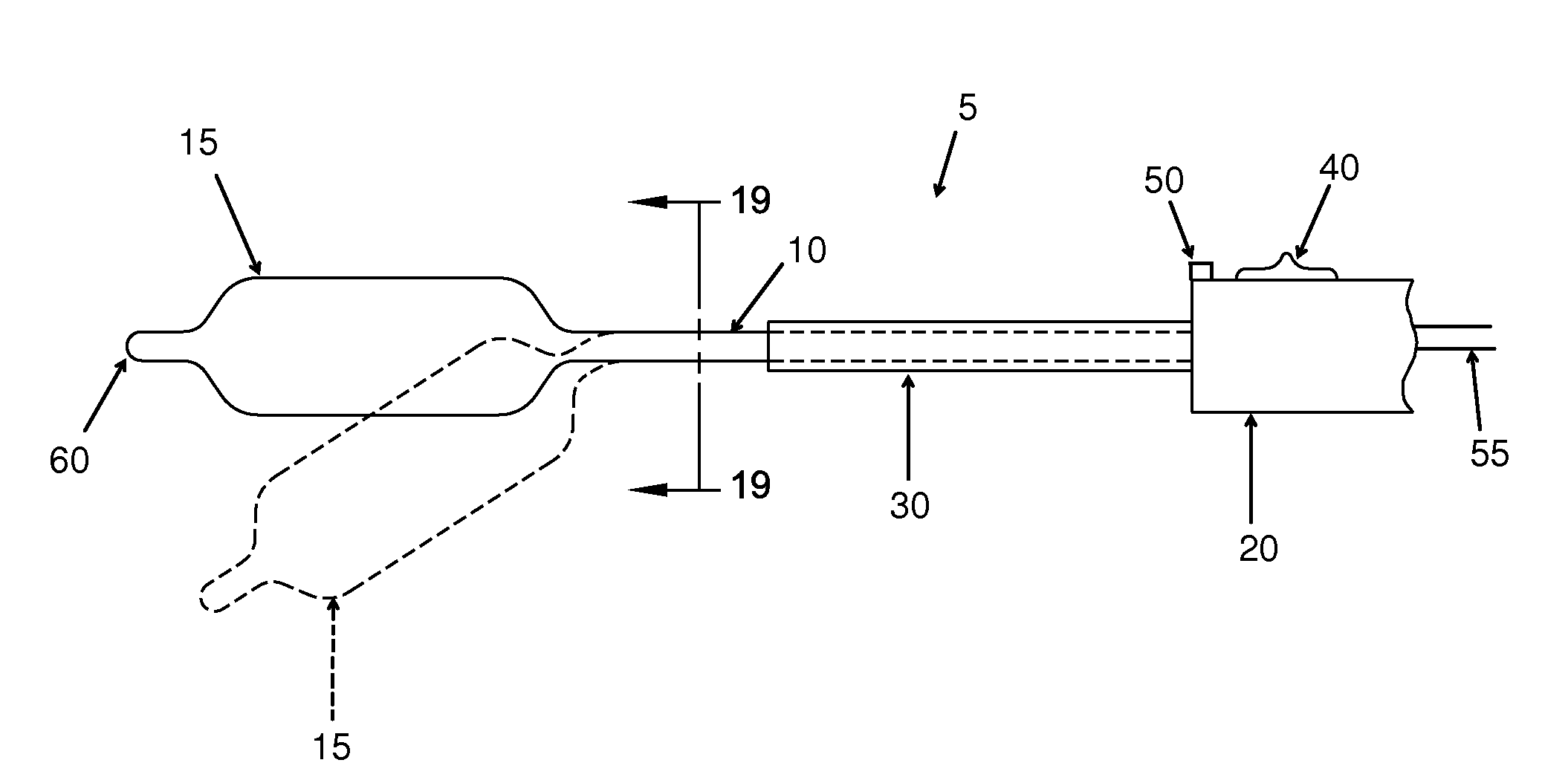 Method and apparatus for distracting a joint, including the provision and use of a novel joint-spacing balloon catheter and a novel inflatable perineal post