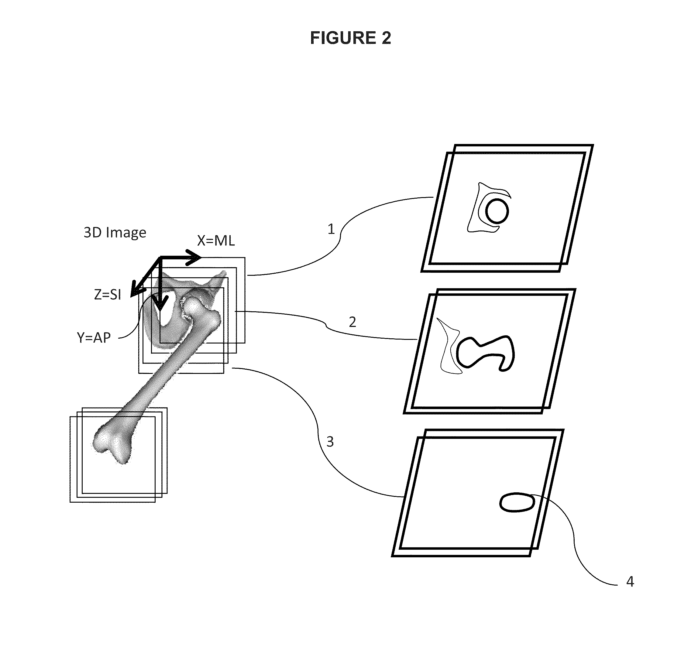 Method and system of automatic determination of geometric elements from a 3D medical image of a bone