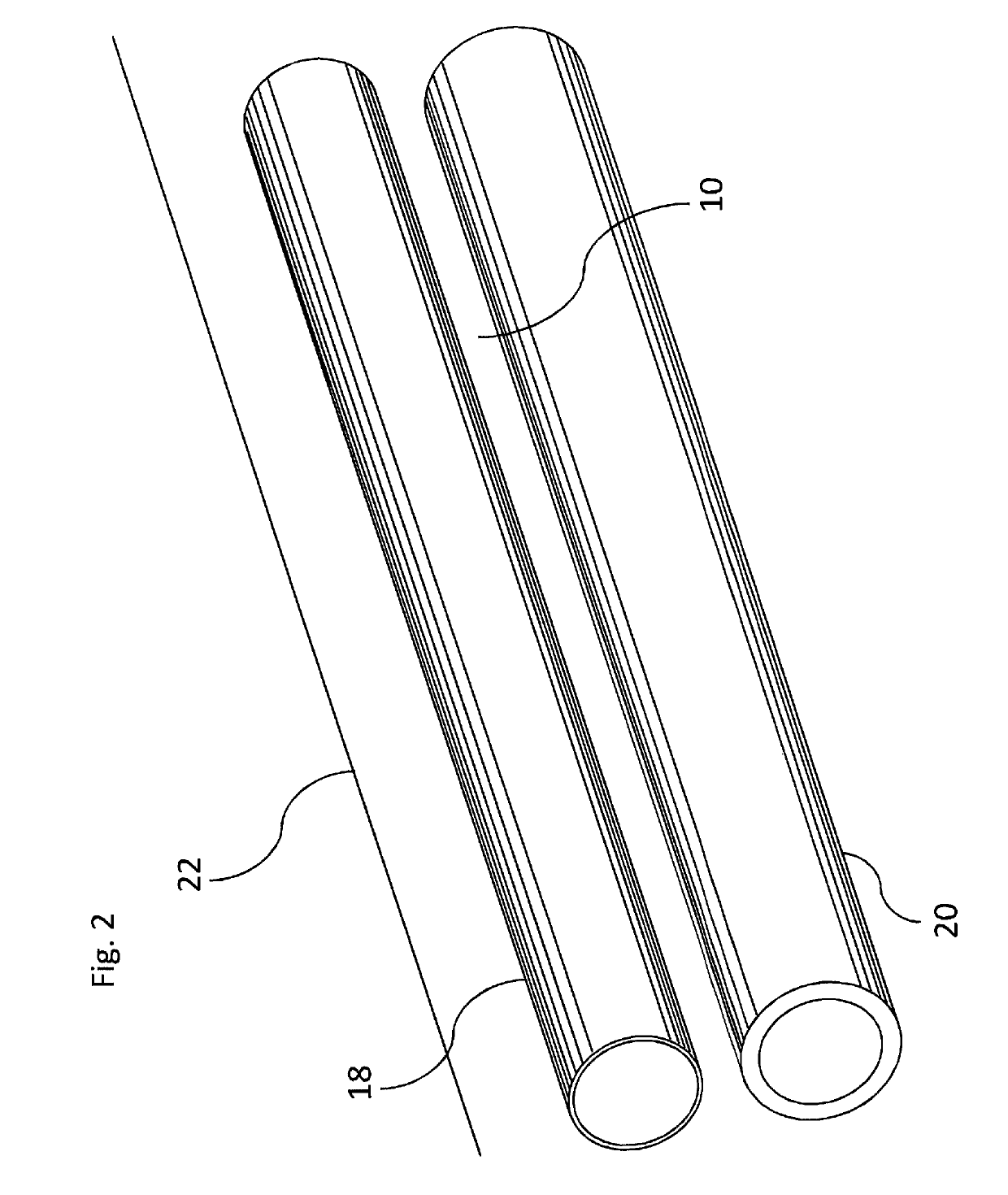 Externally supported anastomosis