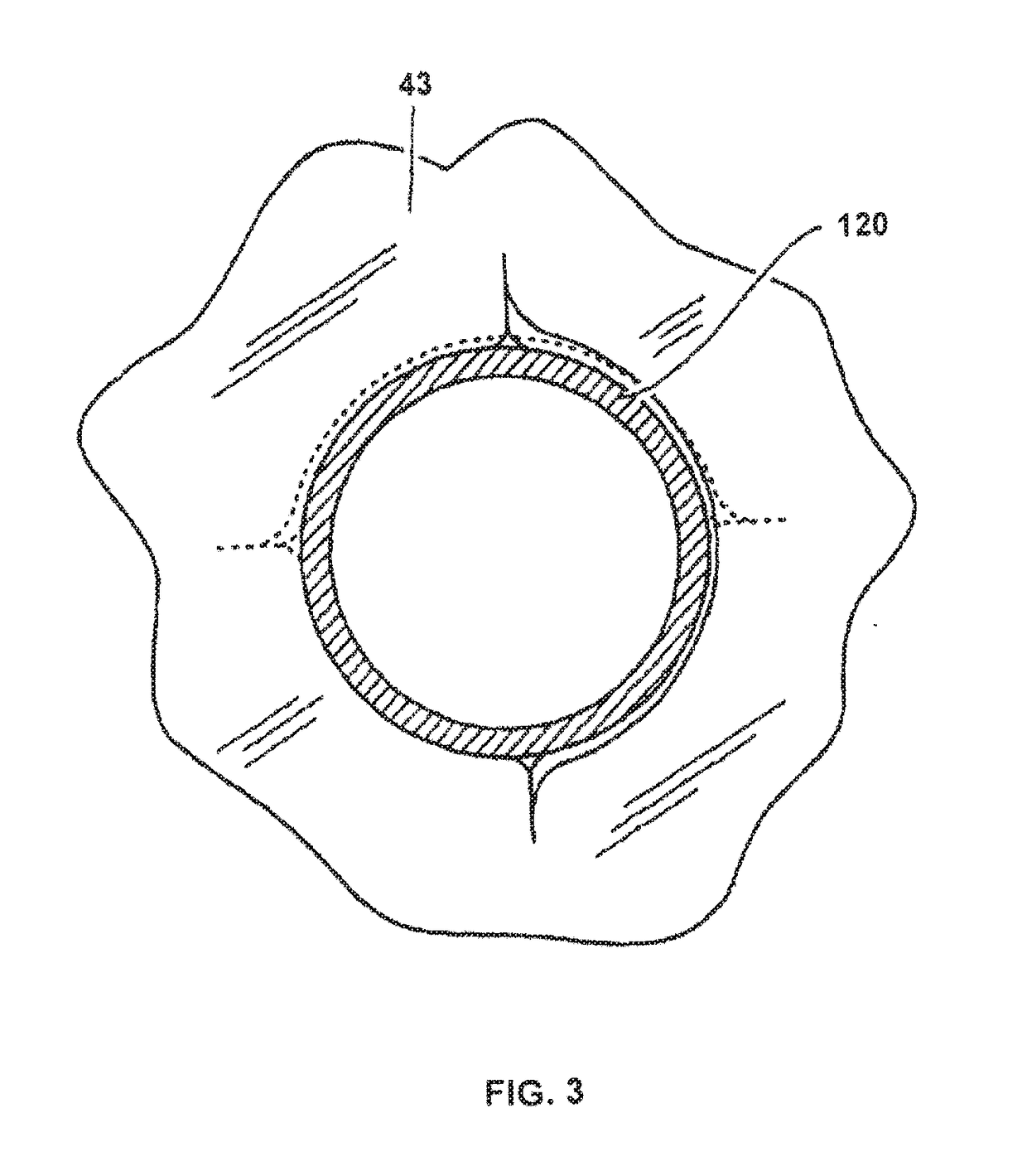 Biocompatible Self-Lubricating Polymer Compositions and Their Use in Medical and Surgical Devices