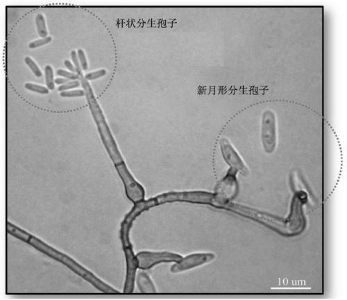 Method for rapidly application of esteya vermicola solid culture product in prevention and treatment of pine wilt disease