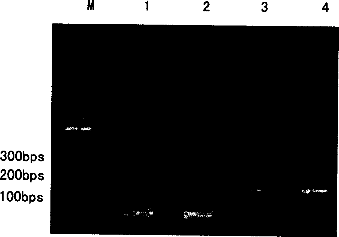 Gene engineering preparation method of human pancreas secreted trypsin inhibitor