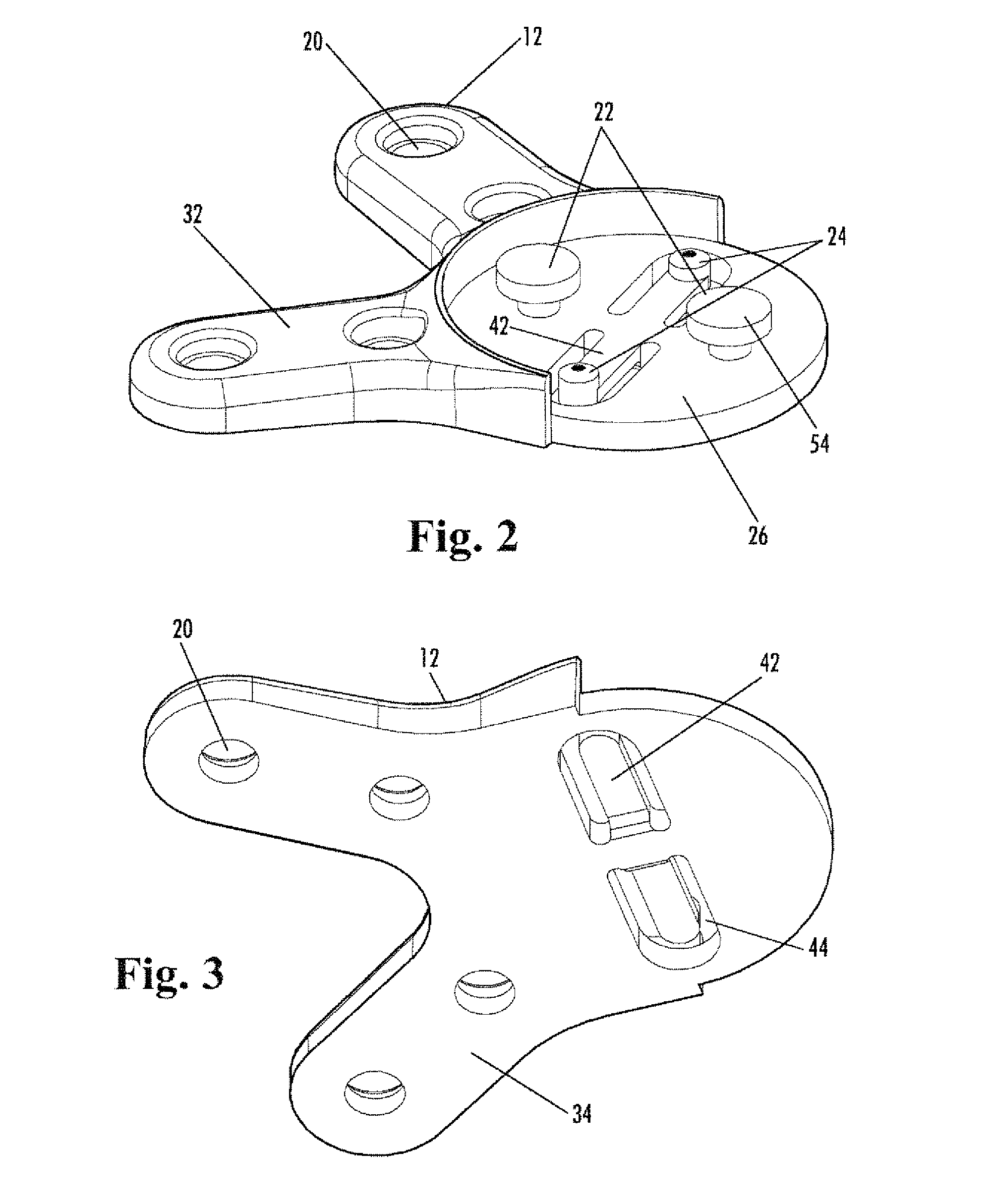 Sternal Closure Device and Method of Using Same