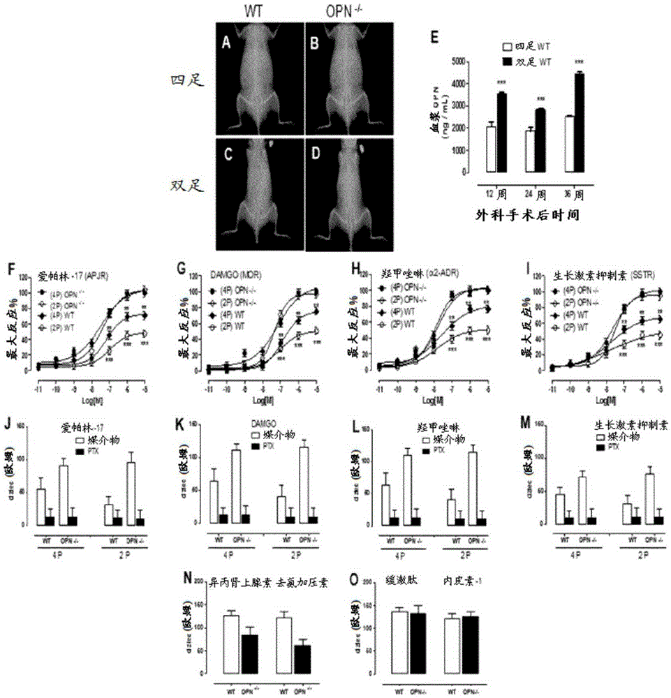 A method of increasing GIPCR signalization in the cells of a scoliotic subject