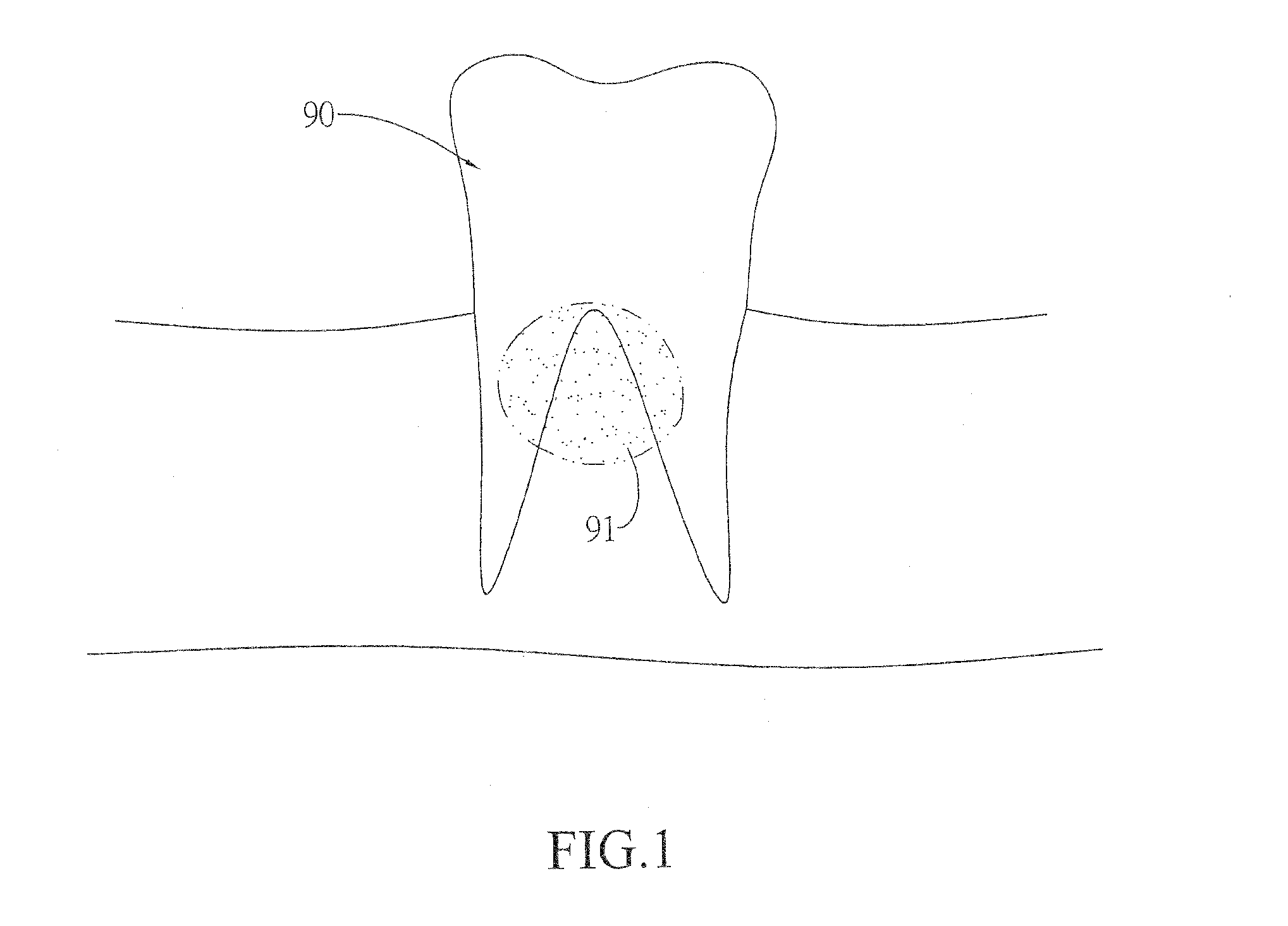 Artificial tooth with multiple internal crowns