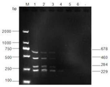 A pathogen multiplex pcr detection kit for chicken common bacterial diseases