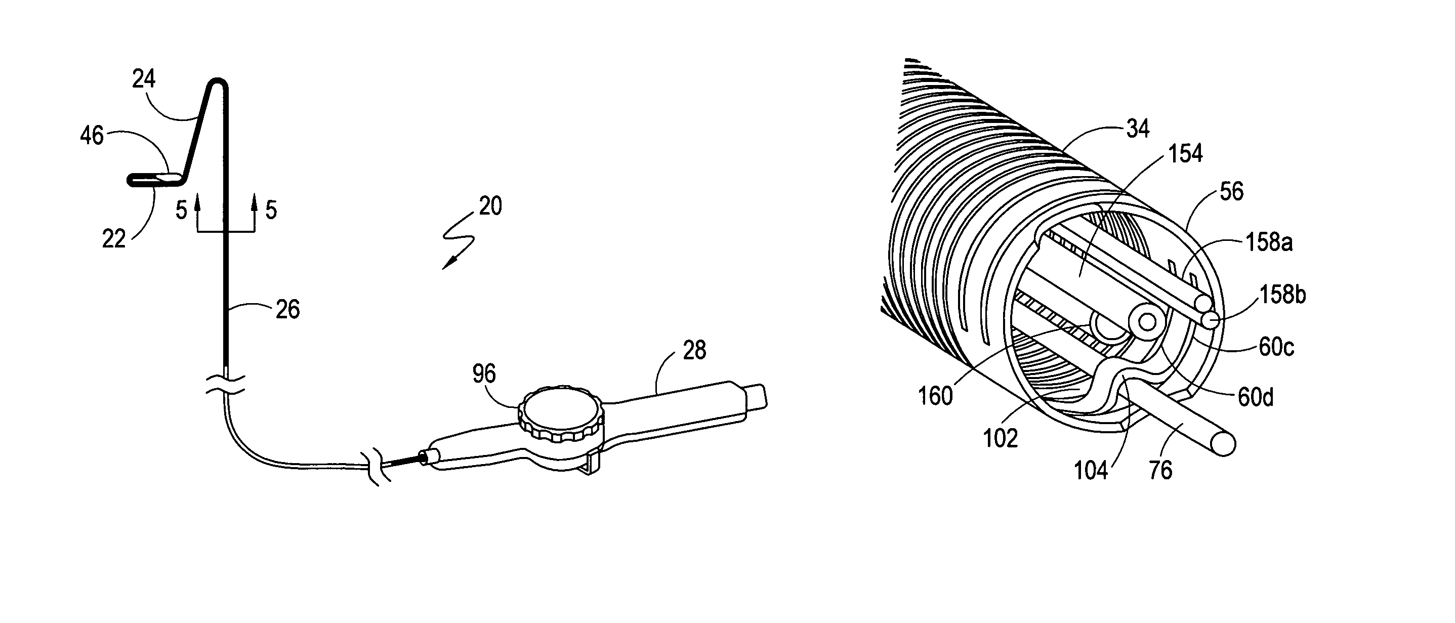 System for bi-directionally controlling the cryo-tip of a cryoablation catheter