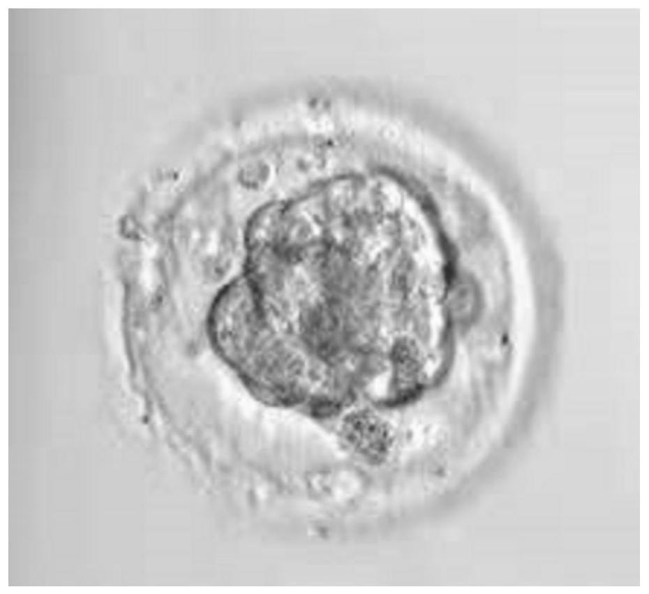 Noninvasive evaluation method and system for embryo quality in human freeze-thaw blastocyst stage and medium
