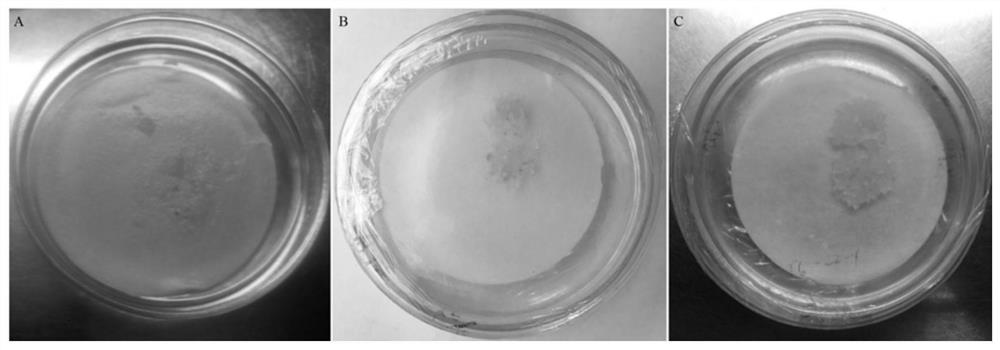 Method for ultralow-temperature preservation of European spruce embryonic calluses